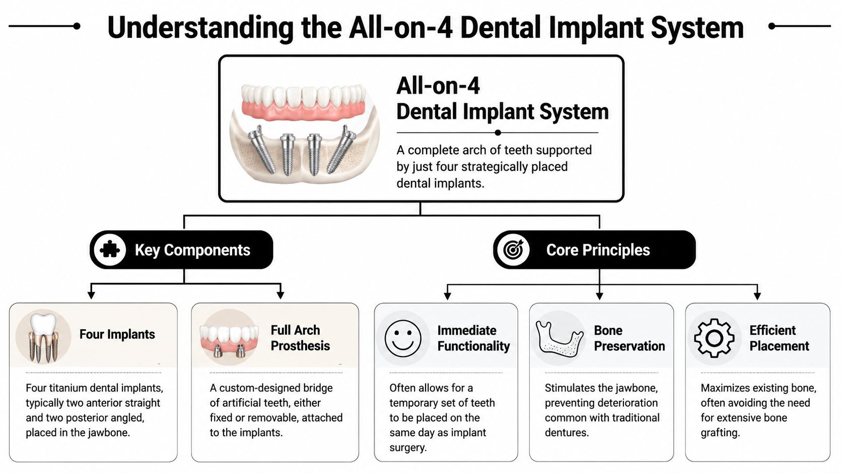 A diagram explaining the All-on-4 dental implant system with its key components and core treatment principles.