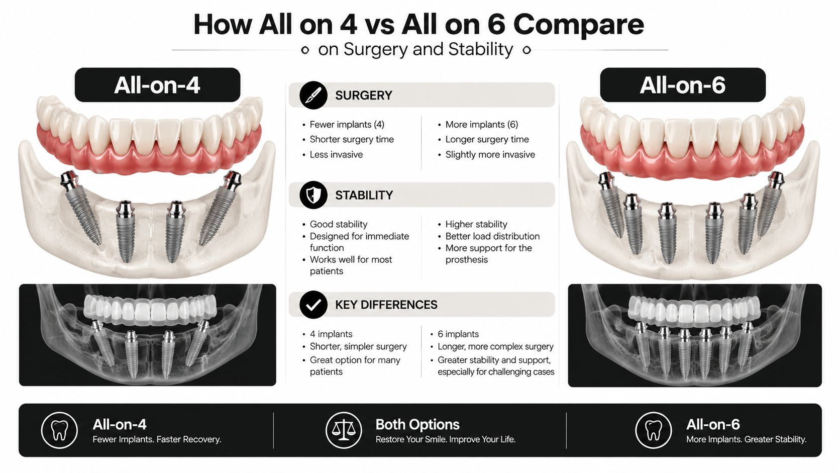 A dental comparison infographic illustrating the differences in implants, surgery time, and stability between All-on-4 and All-on-6 treatments.