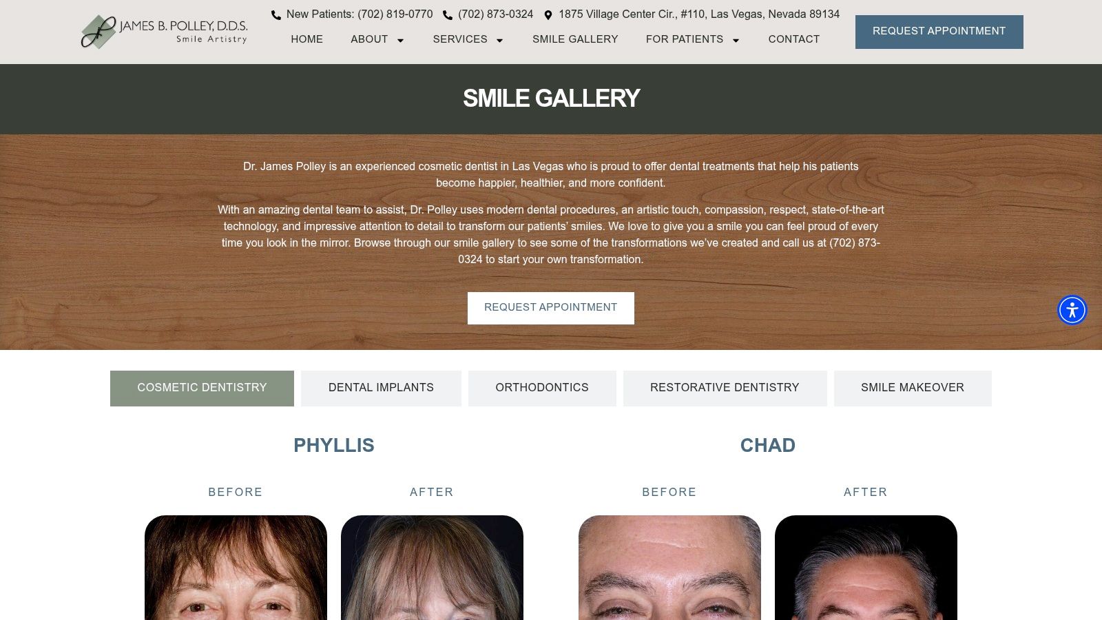 Case 7: Restoring a Youthful Smile with Crowns and Implants