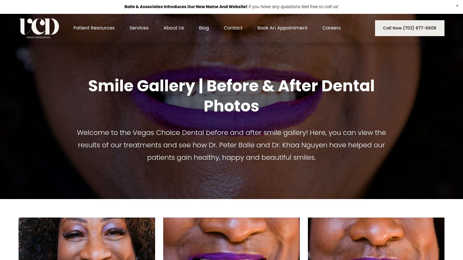 Case 5: The Complete Smile Reset with All-on-4®
