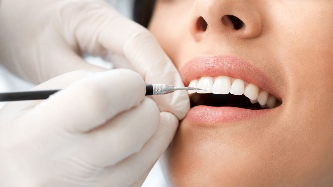Dental professional examining teeth for cosmetic bonding or veneers procedure.