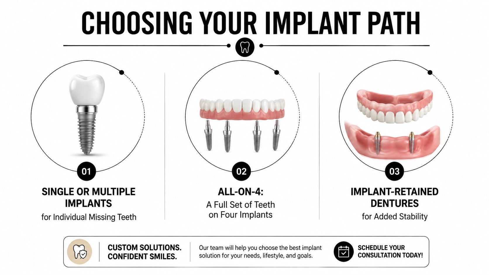 A dental guide showing three types of dental implants including single implants, all-on-4, and implant-retained dentures.