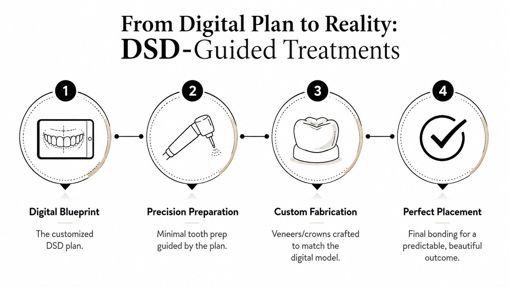 A four-step infographic illustrating the Digital Smile Design process from digital planning to final treatment outcome.