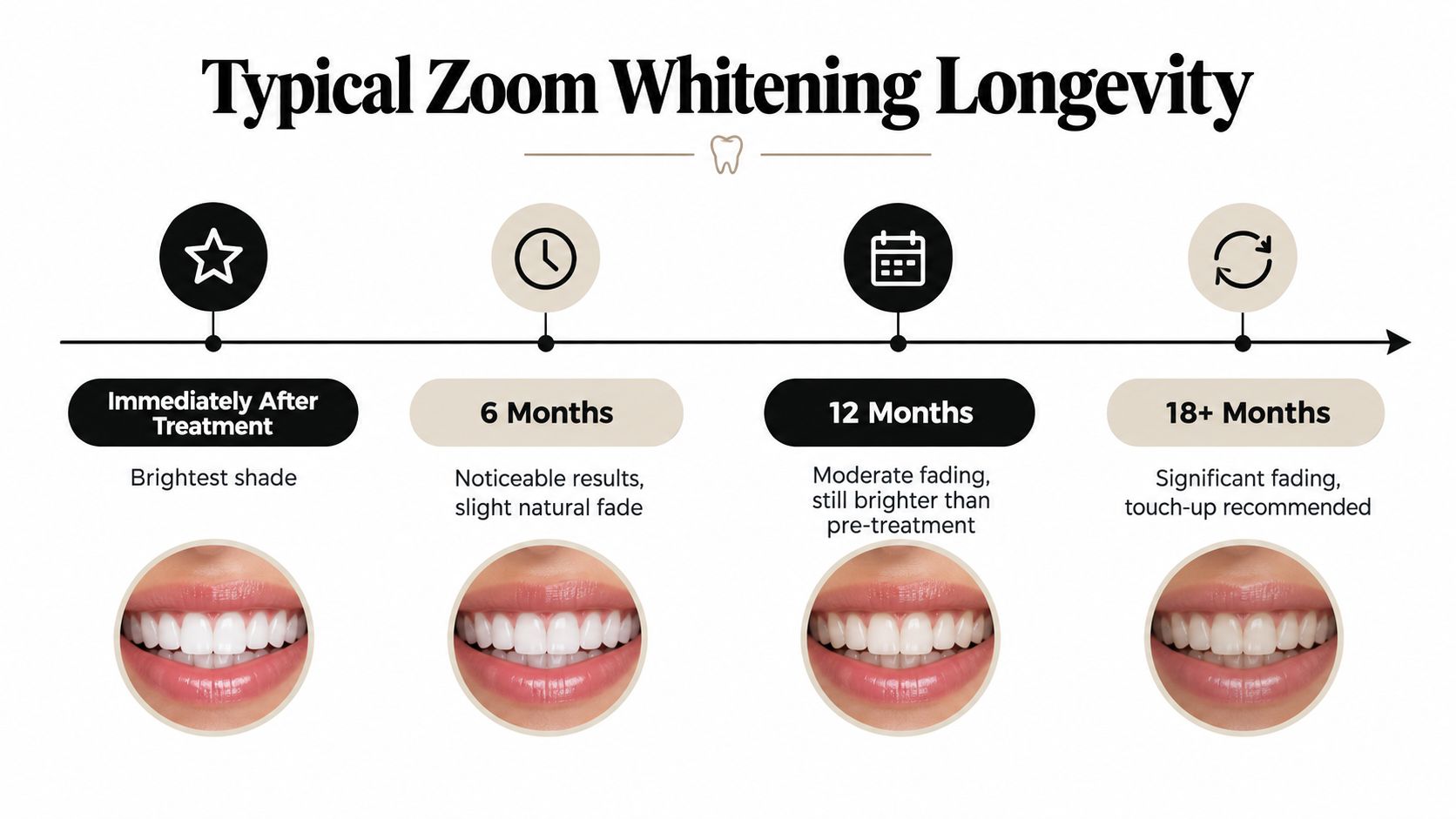 A timeline graphic showing the typical progression and fading of Zoom teeth whitening results over eighteen months.
