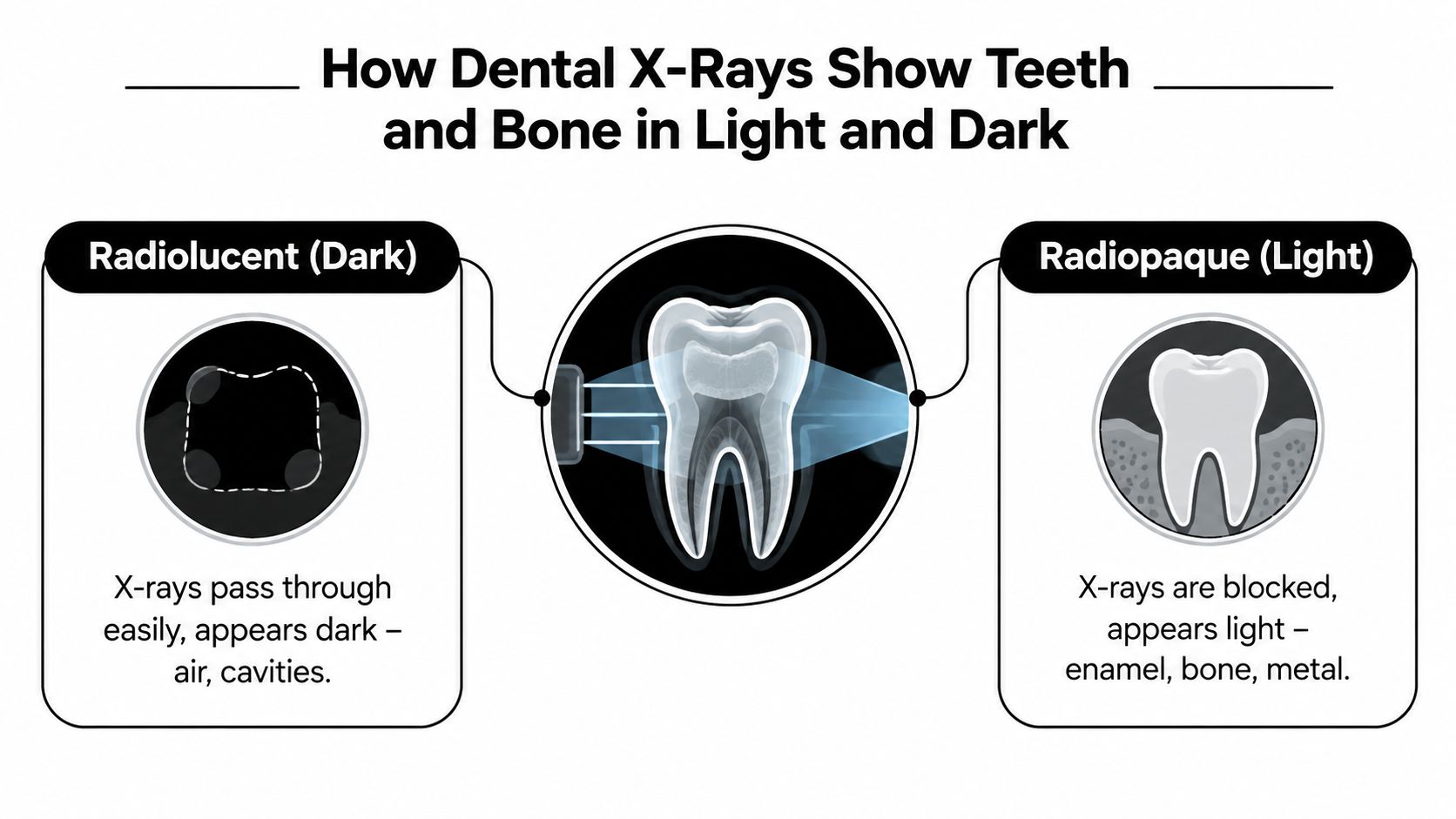 An infographic explaining how dental X-rays show radiolucent dark areas and radiopaque light areas of teeth.
