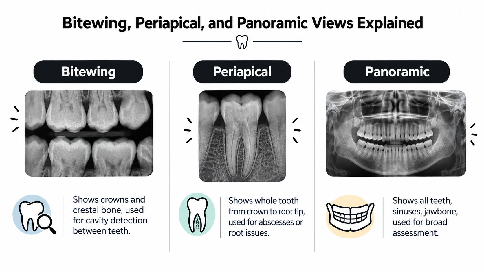 A dental infographic comparing bitewing, periapical, and panoramic x-ray images and their specific diagnostic purposes.