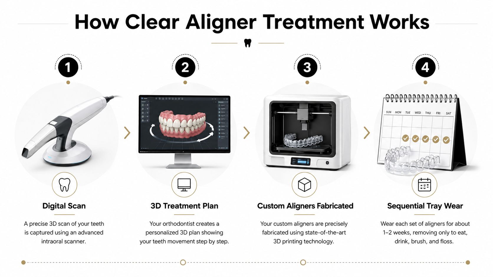 An infographic detailing the four steps of clear aligner treatment from digital scanning to final usage.