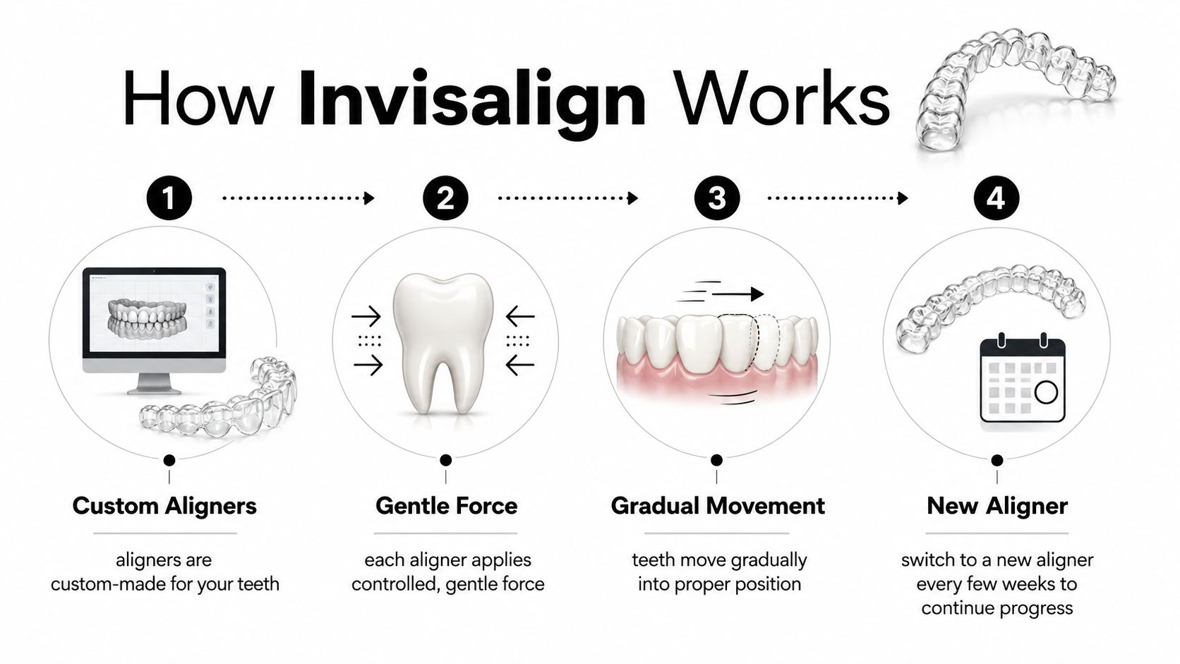 An infographic showing the four steps of how Invisalign treatment works for straightening teeth over time.