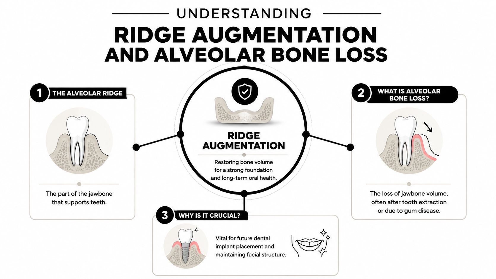 An infographic explaining ridge augmentation and alveolar bone loss, showing jawbone support and dental implant benefits.