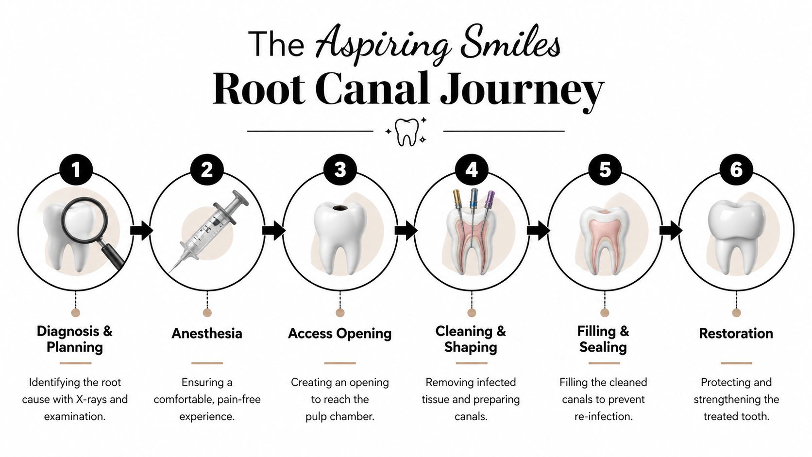 A six-step infographic detailing the root canal procedure from diagnosis to final restoration of the tooth.