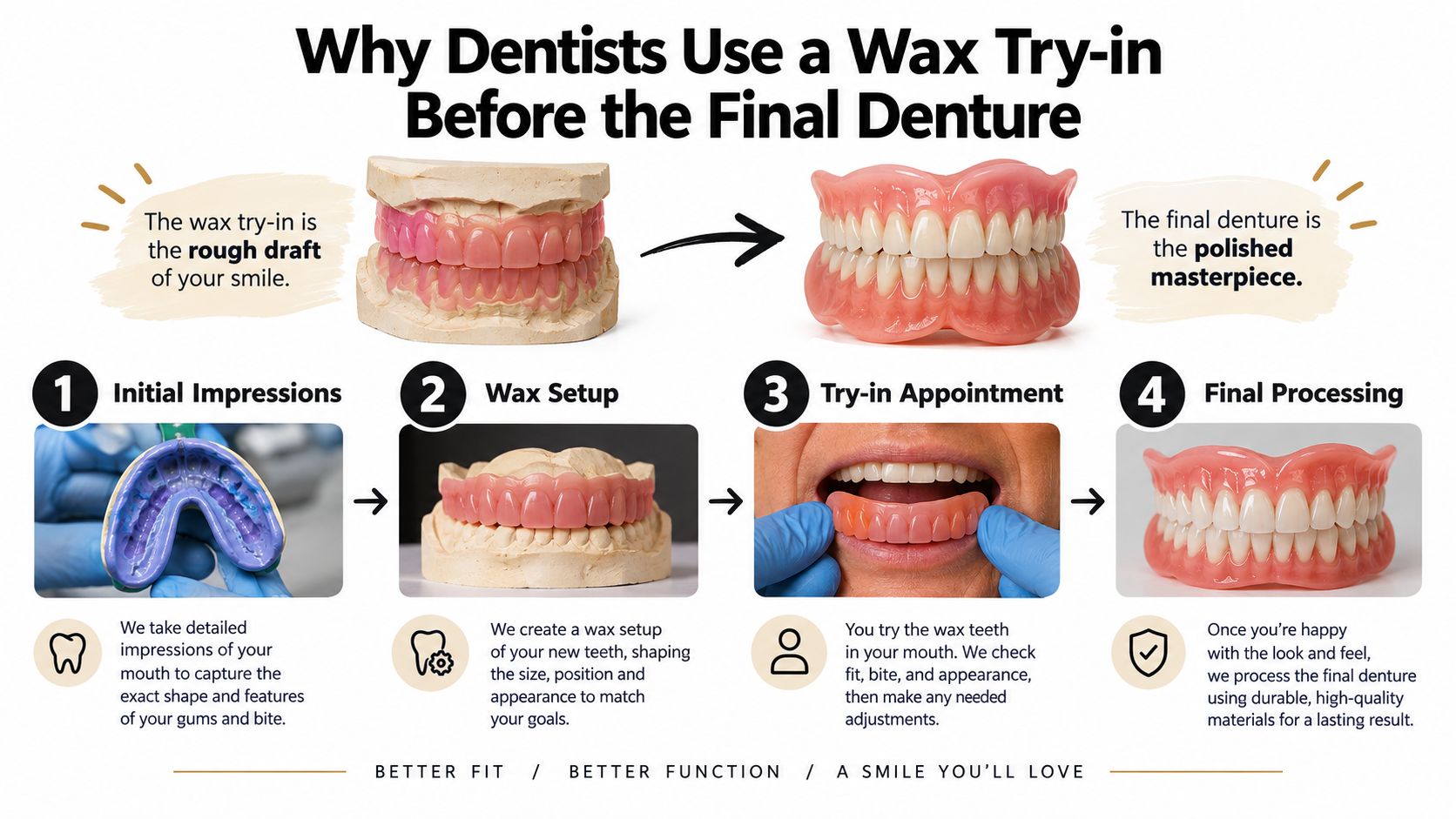 A diagram illustrating the four-step dental process from initial impressions to the final processed denture smile.