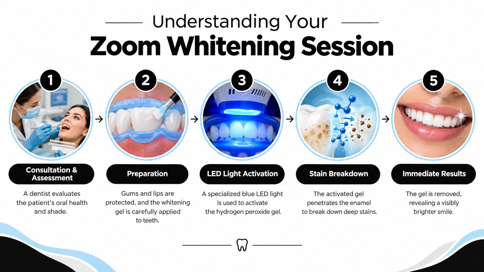 An infographic showing the five-step process of a professional Zoom teeth whitening session at a dentist's office.