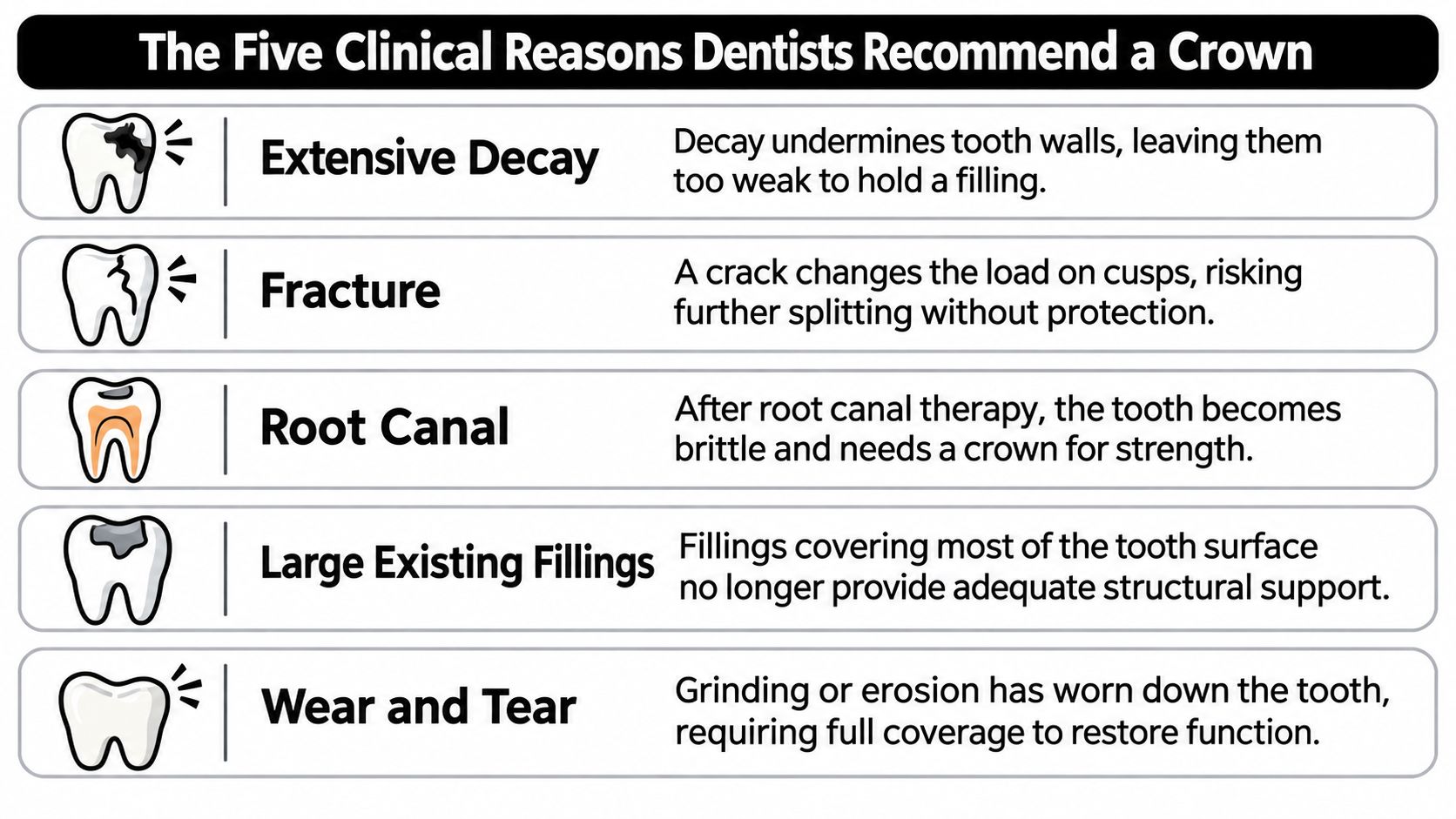 An infographic illustrating five clinical reasons why dentists recommend a dental crown for restoring tooth structure.