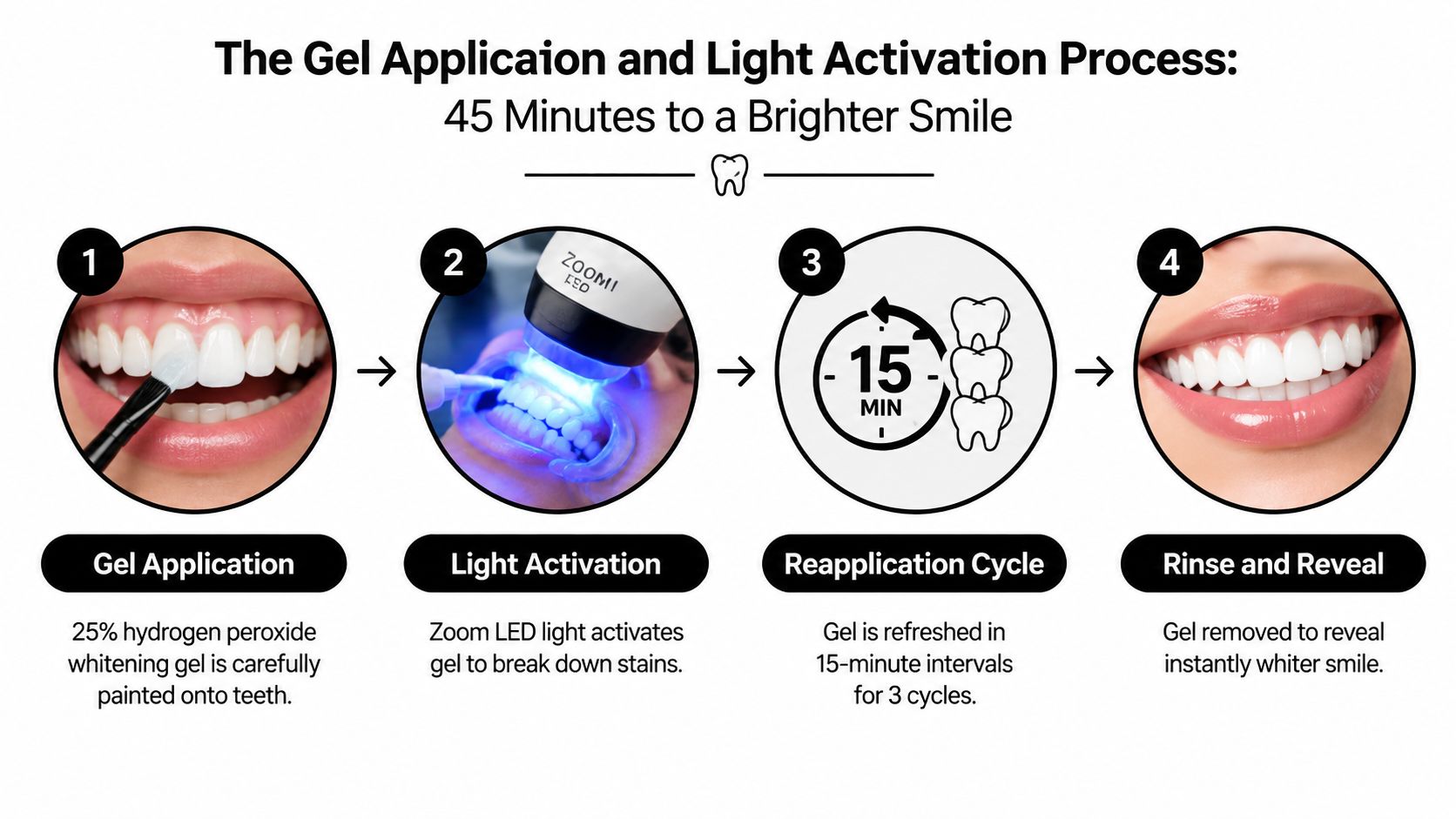 A four-step infographic illustrating the professional Zoom whitening process for achieving a brighter smile in 45 minutes.